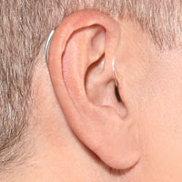 Behind The Ear Hearing Aid (BTE)